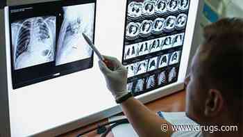 Experts Widen Criteria for Those Who  Should Get Lung Cancer Screening