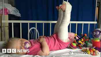 Hip dysplasia: Children's book tells story of girl's treatment