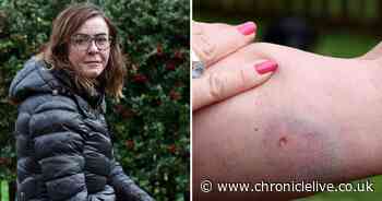 'It was biting me really hard' - Woman injured after 'dog attack' on Northumberland beach