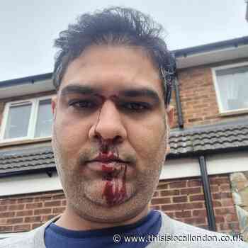 Harold Hill 'racist attack' leaves father-of-three injured