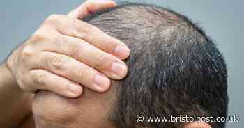 People with receding hairlines can now invoice their grandad for a hair transplant