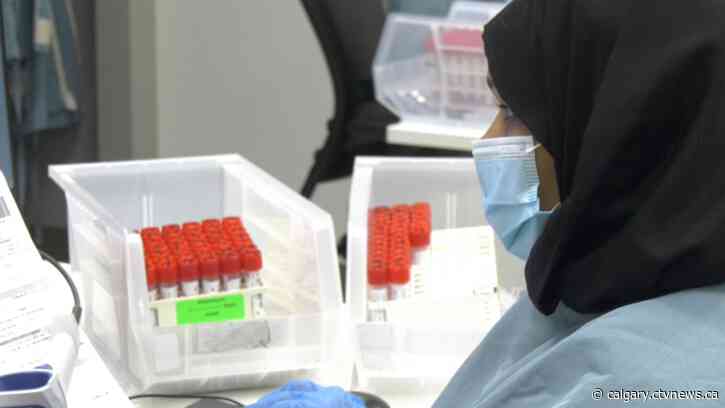 Without DynaLife, Alberta's lab wait times are decreasing: AMA