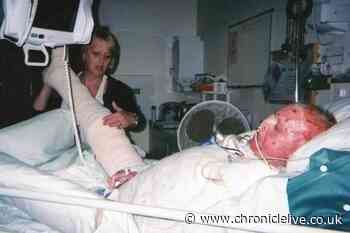 Man's Bonfire Night warning after suffering 90% burns to body playing with aerosols