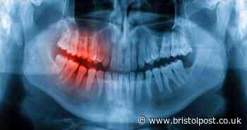 Dentist warns how cold weather can damage your teeth and symptoms to look for