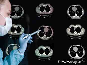 CT Screening Greatly Boosts Lung Cancer Survival: Study