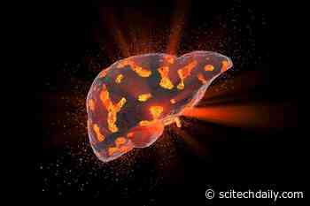 Scientists Uncover Potential Treatment for Non-Alcoholic Fatty Liver Disease