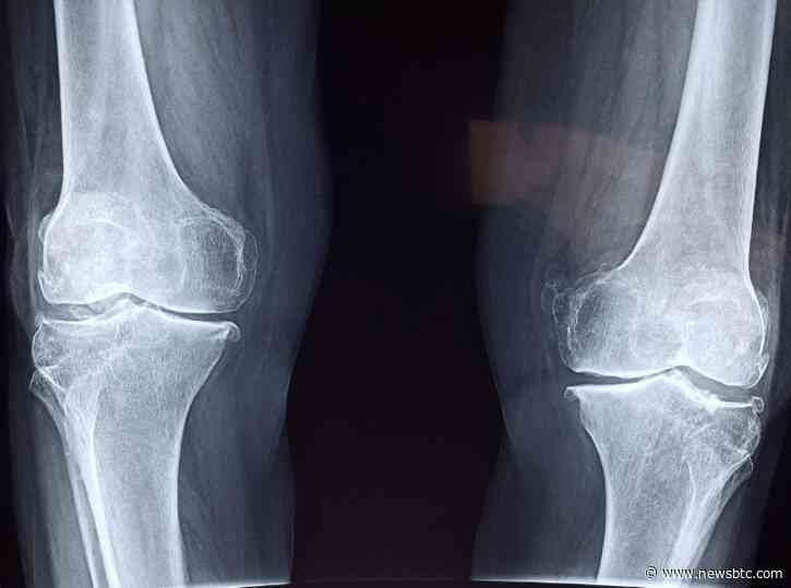 Shibarium Network Lull – How It Affects The Future Of BONE