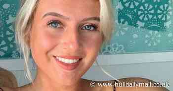 Young woman discovers horror skin condition was caused by eczema cream