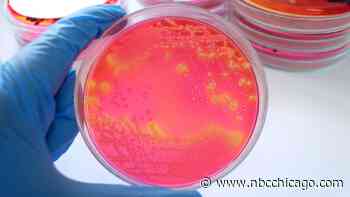 Salmonella outbreak linked to recalled pet food, officials say