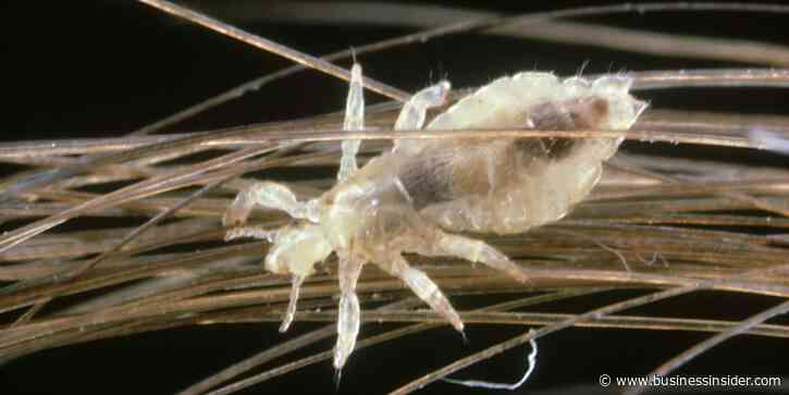 How lice evolved alongside humans to become the perfect pests &mdash; and trackers of human migration