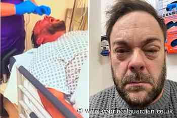 Surbiton alkaline attack victim rushed to Kingston A&E