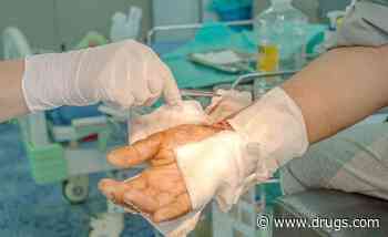 Study Looks at Access to U.S. Burn Centers Using 2019 Data