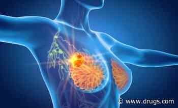 Low-Dose Positron Emission Mammography Helps ID Breast Cancer