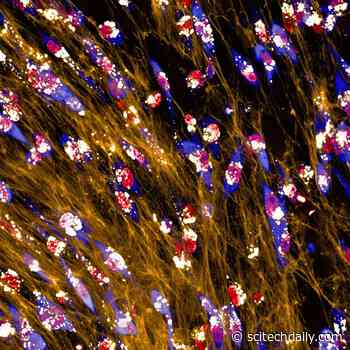 Scientists Discover How Breast Cancer Outsmarts Starvation