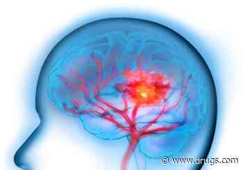 ASA: Endovascular Thrombectomy Beneficial for Large Ischemic Stroke