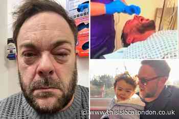 Surbiton ‘acid attack’ victim's plea for better support