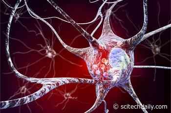 Scientists Propose “Radically Different” New Way of Looking at Parkinson’s Disease