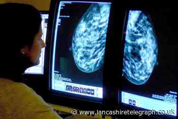Breast cancer symptoms, causes and treatment available