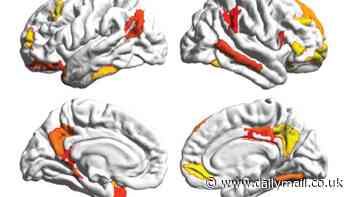 Proof men and women really are 'wired differently': Brain scans show differences in regions responsible for daydreaming, memory and decision making, study finds