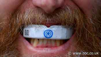 Smart gumshields - chips, change and criticism