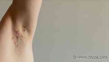 Clinical Markers Improve With IV Ertapenem for Hidradenitis Suppurativa