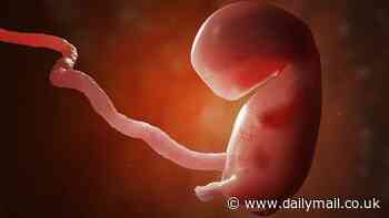 Potentially toxic microplastics are found in 100 PERCENT of human placentas tested by scientists who say 'all mammalian life on this planet could be impacted'