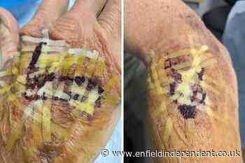 FoI reveals number of TfL ticket barrier injuries in 2023