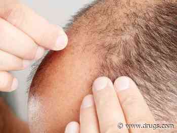 Could Hair Loss Drug Finasteride Help Men's Hearts?