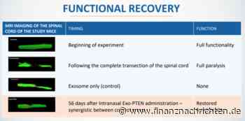 Nurexone Biologic: Ist das das Einstiegssignal vor der erneuten Rallye?