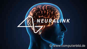Elon Musk vermeldet Neuralink-Meilenstein