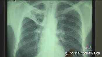 Hospital brings back X-ray walk-in-only services