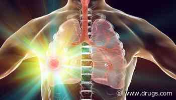 Tislelizumab Plus Chemotherapy Beneficial for Resectable NSCLC