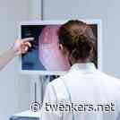 Test AI herkende 40 procent meer poliepen, mogelijk voorstadium darmkanker