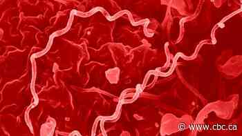 Canada almost wiped out syphilis. Now rates are skyrocketing — as more women, infants getting infected