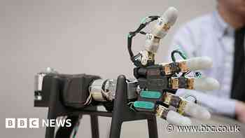The 'mind-bending' bionic arm powered by AI