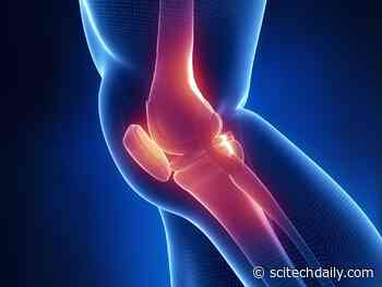 Unraveling the Mystery of Knee Pain: Why Do Some Joint Deformities Hurt While Others Don’t?