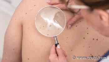 Delayed Melanoma Care During Pandemic Proved Costly