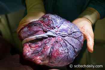 Shocking Study Finds Microplastics in Every Human Placenta