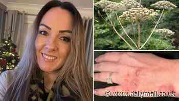 Britain's 'most dangerous plant' strikes in Paisley: Woman is left with painful burns up her arms after accidentally brushing past giant hogweed