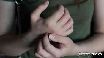 Feeling itchy? Scientists are working to unravel the mysteries behind chronic itch