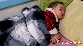 Everything you need to know about protecting yourself against measles