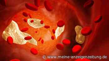 Arteriosklerose: Spüre ich, ob meine Arterien verkalkt sind?