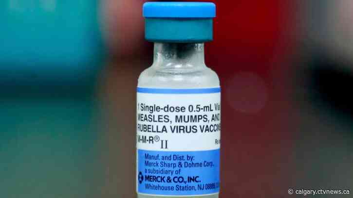 'Highly contagious': Albertans encouraged to get vaccinated for measles as risk of spread increases