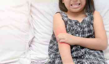Atopic Dermatitis in Children Tied to Learning, Memory Difficulties