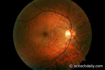 New Hope for Preventing Blindness: Unlocking the Microbial Mystery Behind Inherited Eye Diseases