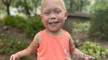 Sask. TikTok star 'Bella Brave' hospitalized after medical emergency, condition 'stable': family