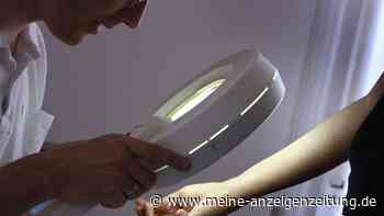 Ehefrau von Daniel Aminati bekam Hautkrebs-Diagnose – woran Sie ein malignes Melanom erkennen