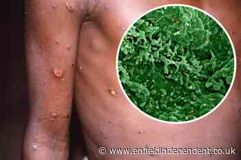 Londoner with HIV who caught mpox was left unable to eat