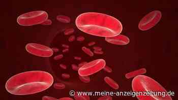 Neue Krebsvorsorge: DNA-Test erkennt 18 Krebsarten im Frühstadium