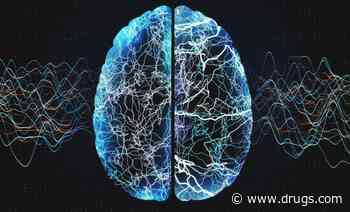 No Brain Injuries Seen Among 'Havana Syndrome' Patients